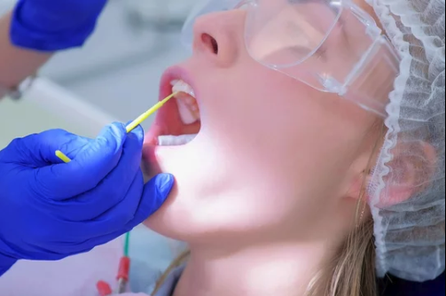 Fluoride Facts: The Truth About Fluoride Treatments and Common Myths